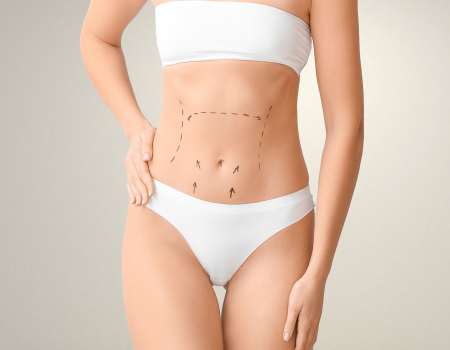 Abdominoplastia em São Paulo